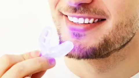 Legyen a mosolyod a legszebb ékszered! – BlancOne Ultra fogfehérítés Budapesten 3