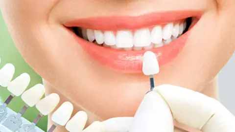 Legyen a mosolyod a legszebb ékszered! – BlancOne Ultra fogfehérítés Budapesten 2