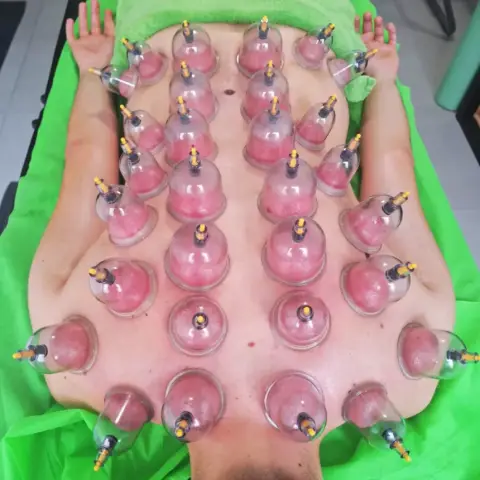 Köpölyözés – A testi-lelki harmónia ősi módszere Budapesten